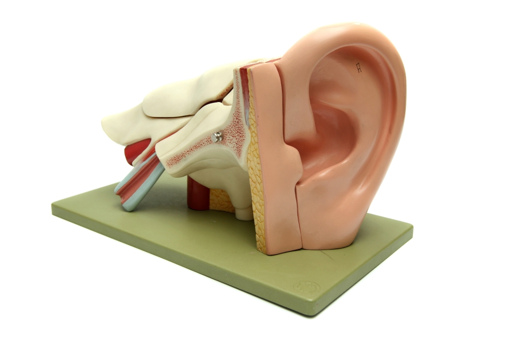 Idiopathic Sudden Sensorineural Hearing Loss (SSHL)